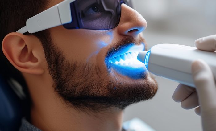 Teeth Whitening au laser à Riyadh