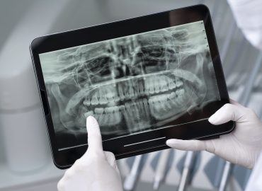 close-up-dentist-instruments (2) (1)