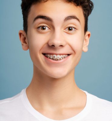 Closeup portrait of surprised boy with dental braces on teeth looking at camera isolated on blue background. Health care, orthodontic concept