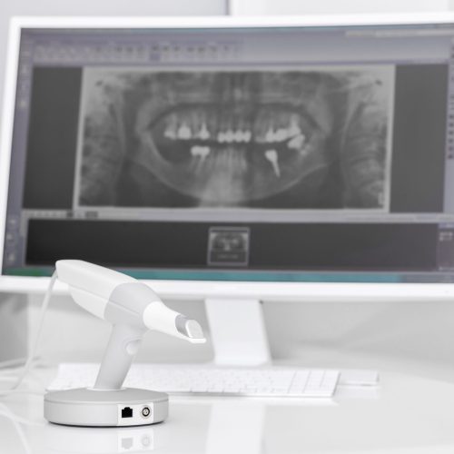 Dental 3D Scanner and Monitor in the Dentist's Office