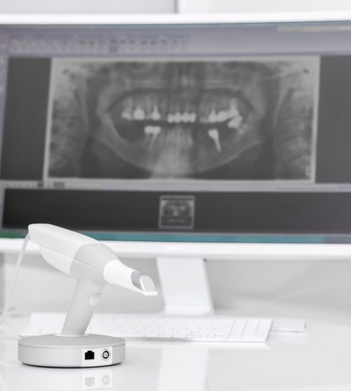 Dental 3D Scanner and Monitor in the Dentist's Office