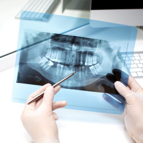 dentist-analyzes-x-ray-photo (1)
