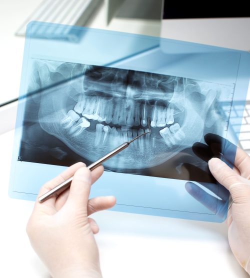 dentist-analyzes-x-ray-photo (1)