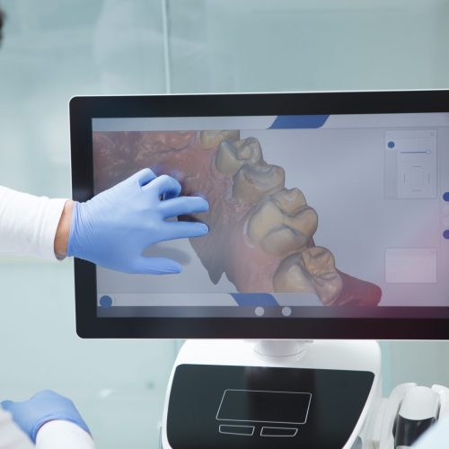 Dentist examining dental scan of a patient on the computer screen