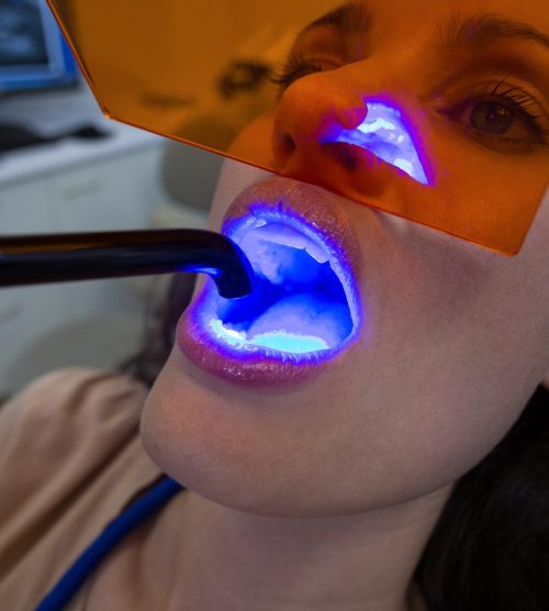 Dentists examining female patient with dental curing light in clinic