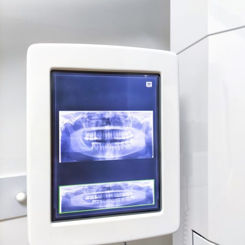 Screen of teeth scan machine in the dental clinic.