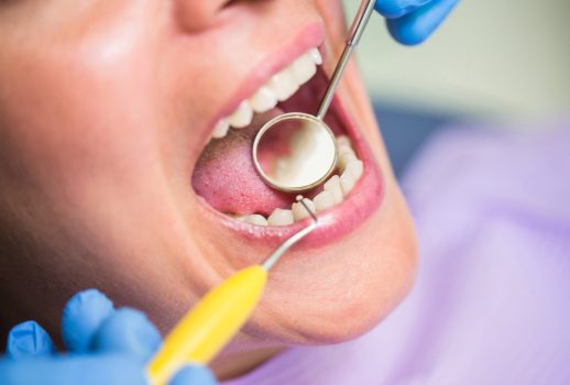 Close-up of dentist examining female patient teeth